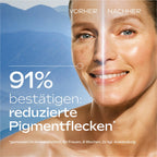 Anti-Pigmentflecken Bright Serum Blauer Enzian&Ede 30 ml